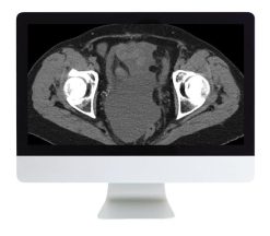ARRS Radiologic Reasoning A Rapid Fire Multispecialty Review 2018 | Medical Video Courses.