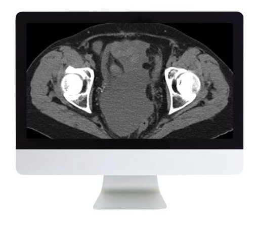ARRS Radiologic Reasoning A Rapid Fire Multispecialty Review 2018 | Medical Video Courses.