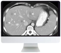 ARRS SAR Disease-Focused Panels: Cancer Imaging and Reporting Guidelines 2021