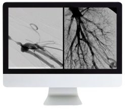 ARRS Vascular and Interventional Radiology Review 2016 | Medical Video Courses.