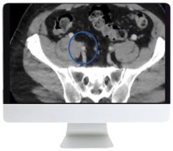 ARRS Venous Disease: Exploration of Advances, Challenges, and Future Directions 2021