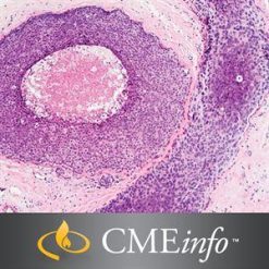 Breast Pathology Masters of Pathology Series 2020 | Medical Video Courses.