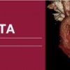 Classic Lectures in Cardiac CTA 2018 (Videos) | Medical Video Courses.