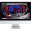 Clinical Ultrasound Review (ARRS) | Medical Video Courses.
