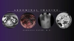 CME Science Abdominal Imaging – Gabriela Gayer