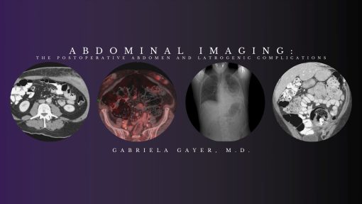 CME Science Abdominal Imaging – Gabriela Gayer