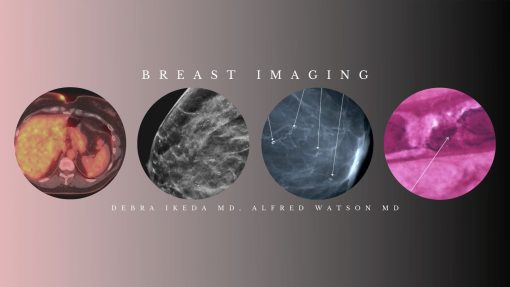 CME Science Breast Imaging (BUNDLE) – Debra Ikeda M.D.