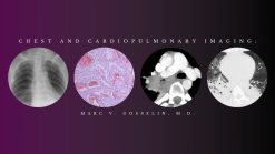 CME Science Chest and Cardiopulmonary Imaging – Marc V. Gosselin