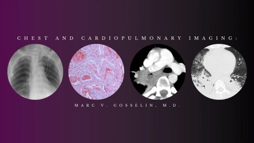 CME Science Chest and Cardiopulmonary Imaging – Marc V. Gosselin