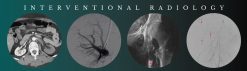 CME Science Interventional Radiology Stephen T. Kee
