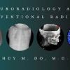 CME Science Neuroradiology and Interventional Radiology 2020 | Medical Video Courses.