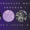 CME Science Prostate MRI (Program 1) – John F. Feller