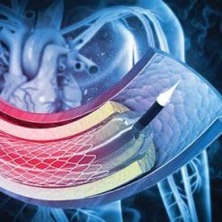 Comprehensive Review and Update of What’s New in Vascular and Endovascular Surgery 2021