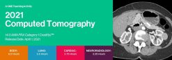 Computed Tomography 2021: National Symposium | Medical Video Courses.