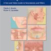 Cosmetic Injection Techniques Neurotoxins and Fillers (Full Videos) | Medical Video Courses.