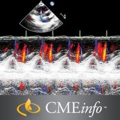 Echocardiography – A Comprehensive Review 2020 | Medical Video Courses.
