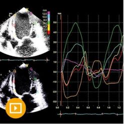 Echocardiography – A Comprehensive Review 2022