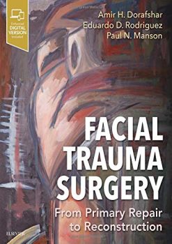 Facial Trauma Surgery: From Primary Repair to Reconstruction (Videos, Organized)