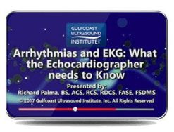Gulfcoast Arrhythmias and EKG: What the Echocardiographer Needs to Know (Videos) | Medical Video Courses.
