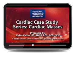 Gulfcoast Cardiac Case Study Series: Cardiac Masses (Videos+PDFs) | Medical Video Courses.