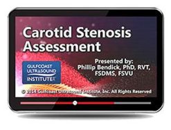 Gulfcoast Carotid Stenosis Assessment (Videos+PDFs) | Medical Video Courses.