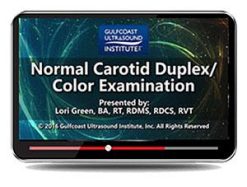 Gulfcoast Normal Carotid Duplex/Color Examination (Videos+PDFs) | Medical Video Courses.