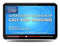 Gulfcoast Ultrasound Evaluation for Calf Vein Imaging (Videos+PDFs) | Medical Video Courses.