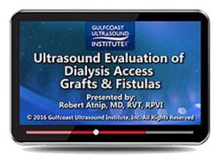 Gulfcoast Ultrasound Evaluation of Dialysis Access Grafts and Fistulas (Videos+PDFs) | Medical Video Courses.