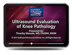 Gulfcoast Ultrasound Evaluation of Knee Pathology (Videos+PDFs) | Medical Video Courses.