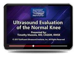 Gulfcoast Ultrasound Evaluation of the Normal Knee Training (Videos+PDFs) | Medical Video Courses.