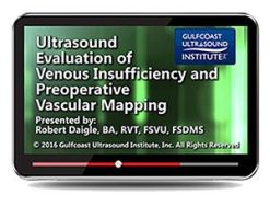Gulfcoast Ultrasound Evaluation of Venous Insufficiency and Preoperative Vascular Mapping (Videos+PDFs) | Medical Video Courses.