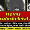 Helms Musculoskeletal MRI 2021 | Medical Video Courses.