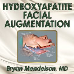 Hydroxyapatite Facial Augmentation