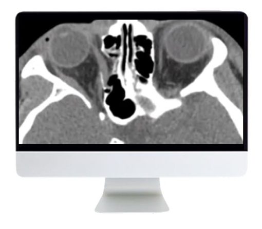 ARRS Imaging Victims of Violence Fists, Stabs, Bullets, and Blasts 2021