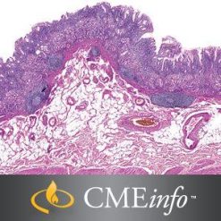 Masters of Pathology : Gastrointestinal Pathology 2018 | Medical Video Courses.
