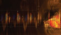 Mayo Clinic Echocardiography Online Board Review 2021 (Videos + Audios + Slides + Assessment) | Medical Video Courses.