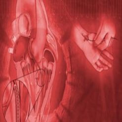 Mayo Clinic Interventional Cardiology Board Review 2019 | Medical Video Courses.
