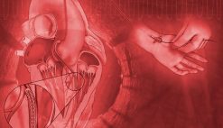Mayo Clinic Interventional Cardiology Online Board Review 2020 | Medical Video Courses.