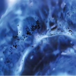 Molecular Diagnostics: Cancer Diagnosis and Patient Management 2021