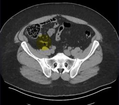 MRIOnline Imaging Mastery Series: Appendix 2021