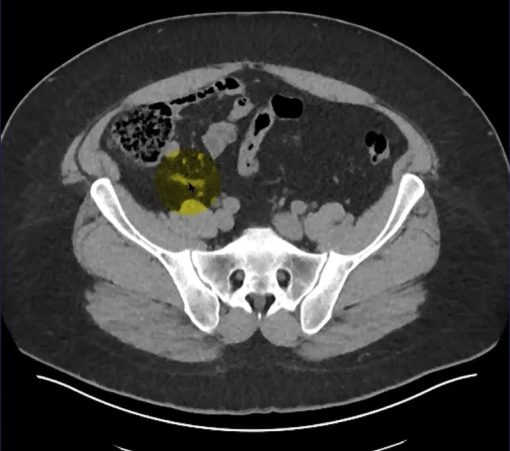 MRIOnline Imaging Mastery Series: Appendix 2021