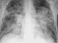 MRIOnline Imaging Mastery Series: Cardiopulmonary Imaging 2021