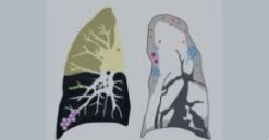 MRIOnline Imaging Mastery Series: Consolidation and Ground Glass 2021