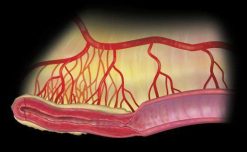 MRIOnline Imaging Mastery Series Crohn’s Disease 2021