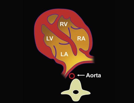 MRIOnline Imaging Mastery Series: Fetal Heart and Great Vessel Evaluation 2021