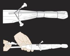 MRIOnline Imaging Mastery Series: Image-Guided Abscess Drainage in Interventional Radiology 2021