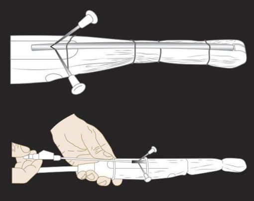 MRIOnline Imaging Mastery Series: Image-Guided Abscess Drainage in Interventional Radiology 2021
