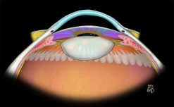 MRIOnline Imaging Mastery Series Orbit 2019