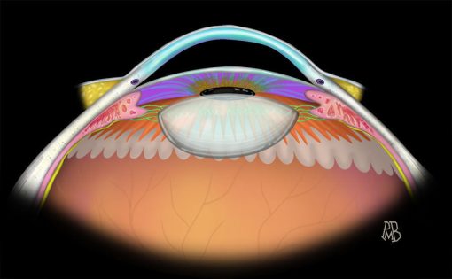 MRIOnline Imaging Mastery Series Orbit 2019