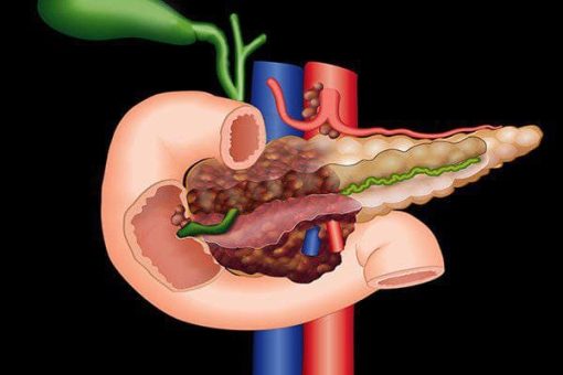 MRIOnline Imaging Mastery Series Pancreas Imaging 2021